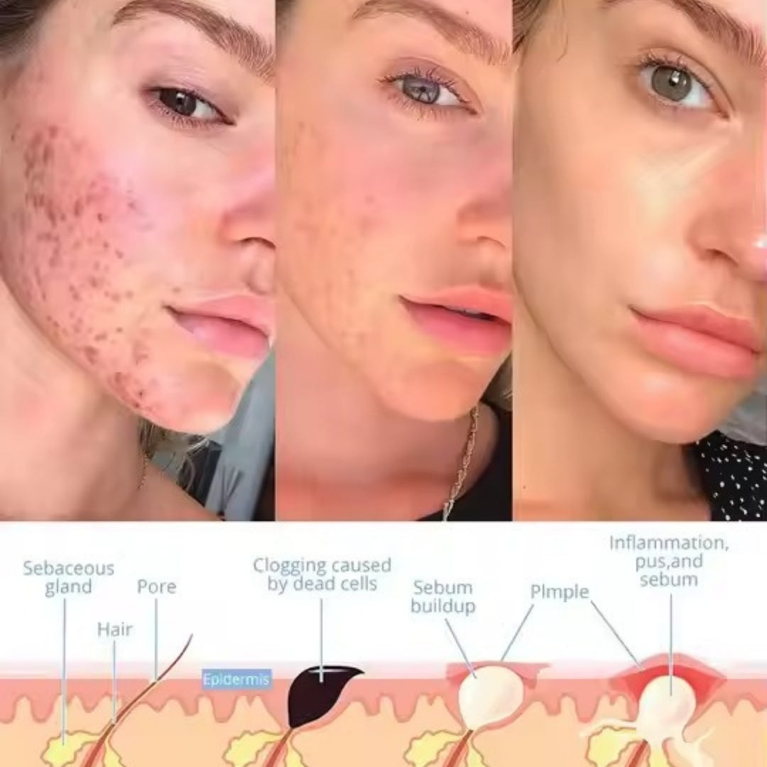 GlowPulse™ Facial Wand