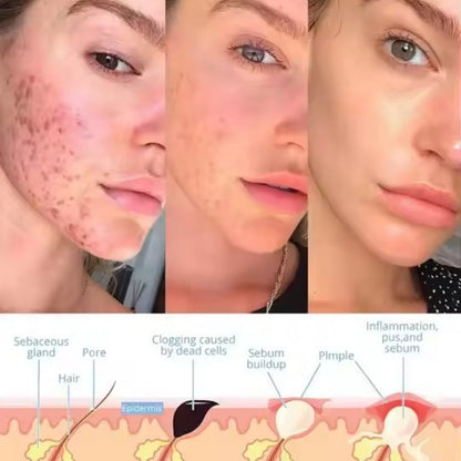 GlowPulse™ Facial Wand